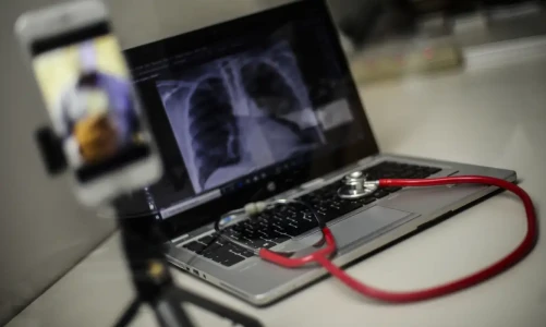 Mutirão De Telemedicina Em Brasília Acelera Concessão De Benefícios Médicos